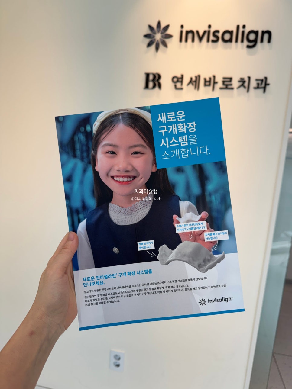 어린이 투명교정 인비절라인 퍼스트 3급 고무줄 주걱턱 덧니 반대교합 개방교합 부정교합 치료 1년 9개월 재제작 2회