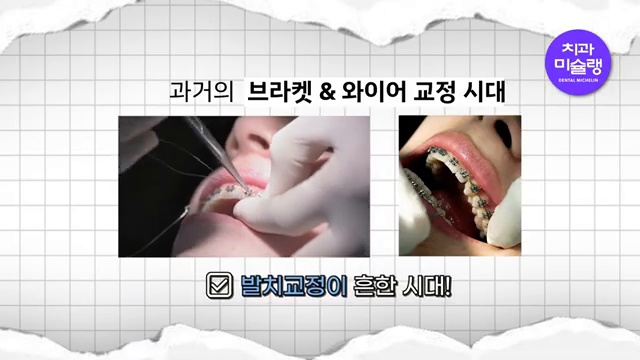 발치 교정, 비발치 교정보다 건강에 안 좋을까? (발치교정 안 하고 싶으시면 필수시청💡🚨)