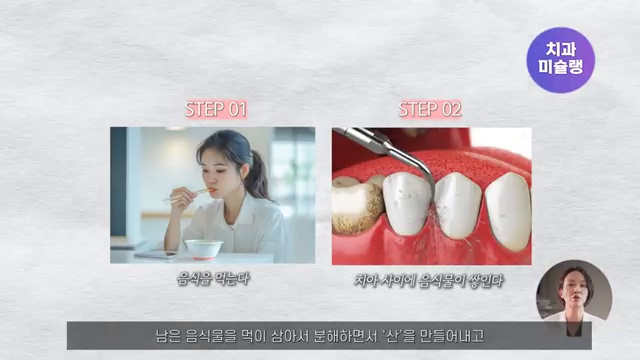 () 가성비 자일리톨 껌 하나로 충치 단번에 예방