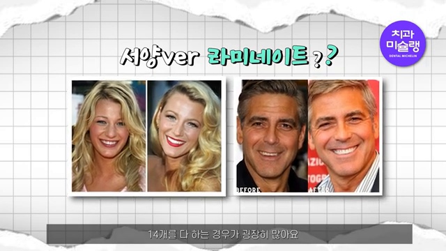 장두형 단두형‼️ 인종별로 선호하는 구강구조 한번에 짚어드립니다✅