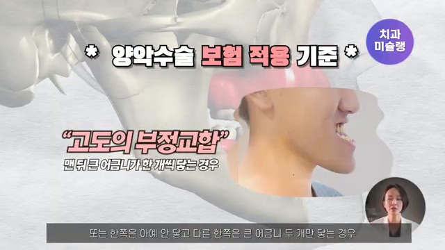 () 부정교합으로 보험적용 군 면제까지? | 오해와 루머 팩트체크 해드립니다